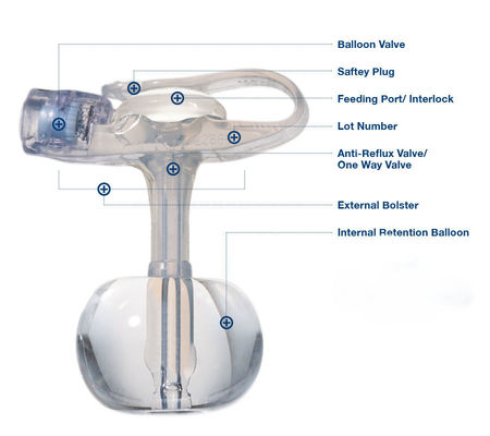 Tubo endotraqueal desechable de silicona estéril Gastrostomía con botón para adultos